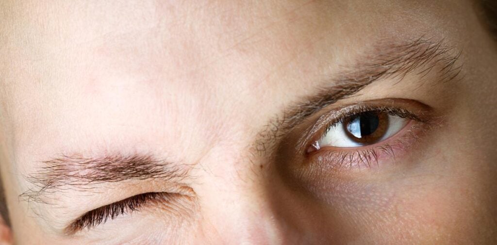 Tardive dyskinesia symptoms
